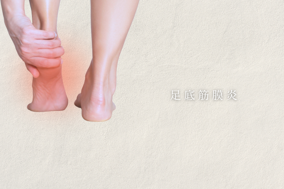 足底筋膜炎でランニングするためのベストプラクティスのヒント